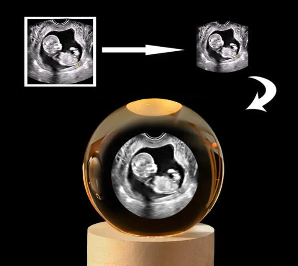 Esfera Personalizada